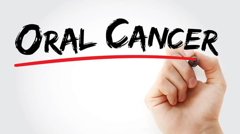 Advanced Oral Cancer Treatments