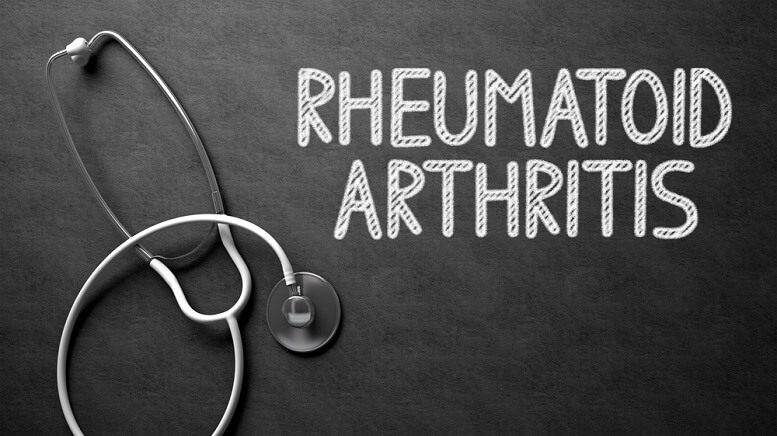 Rheumatoid Arthritis Treatments