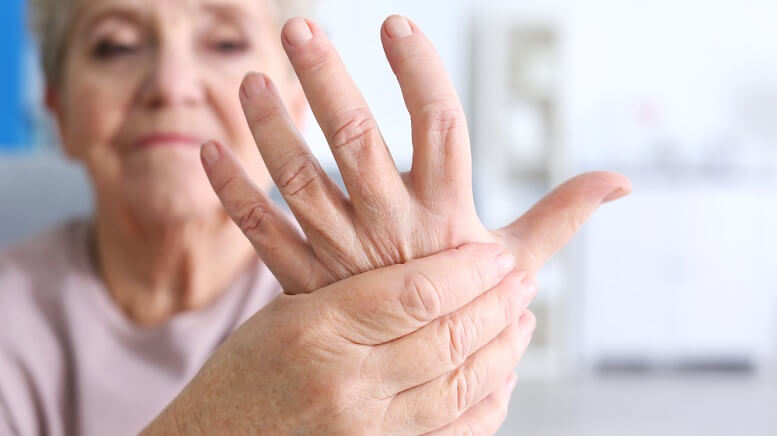 Exercise and Medication as a Treatment of Rheumatoid Arthritis Wrist Pain