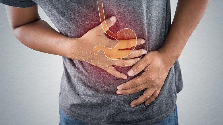 IBS Constipation Treatment Options